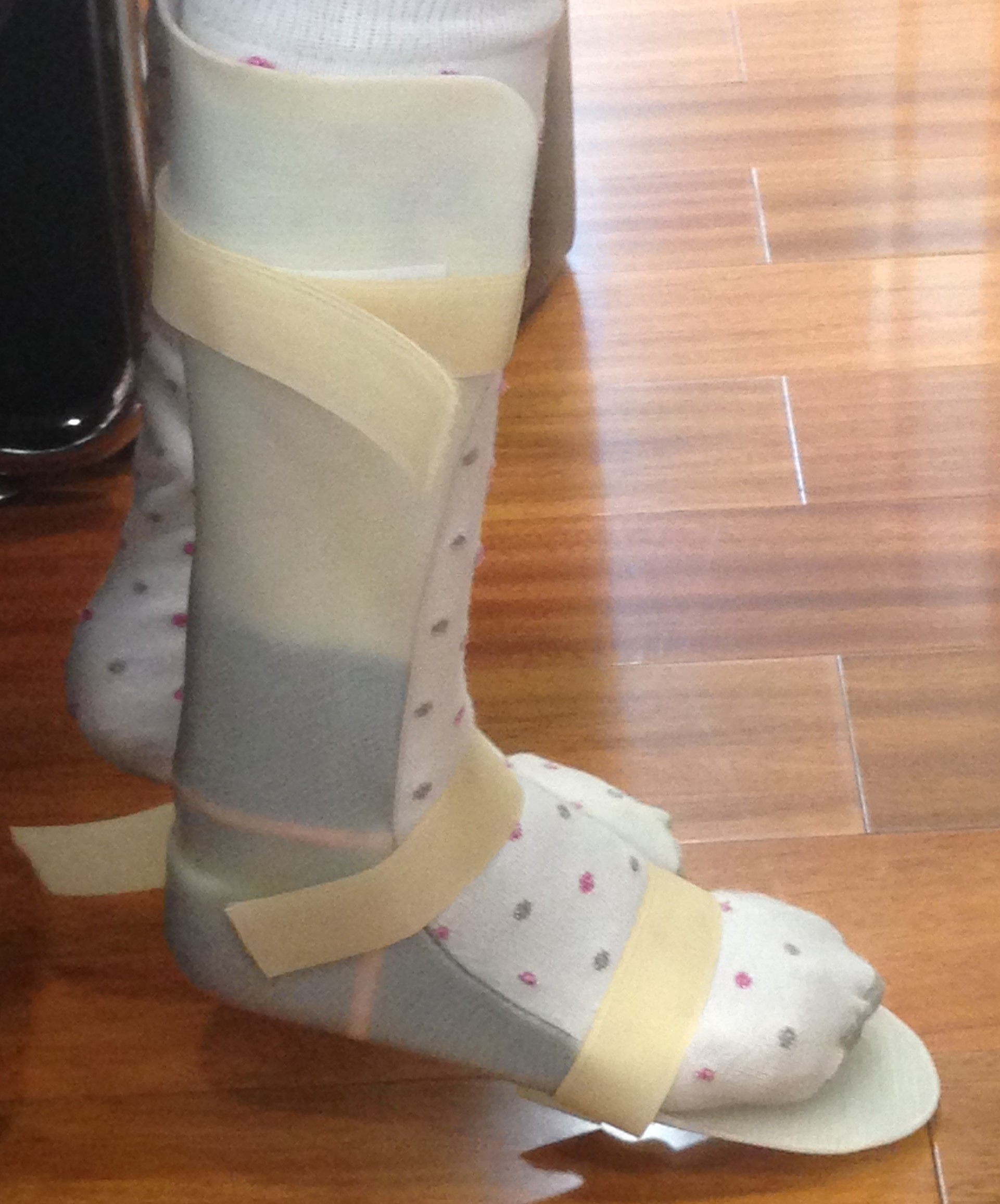 Foot Orthopedic Rehabilitation Device